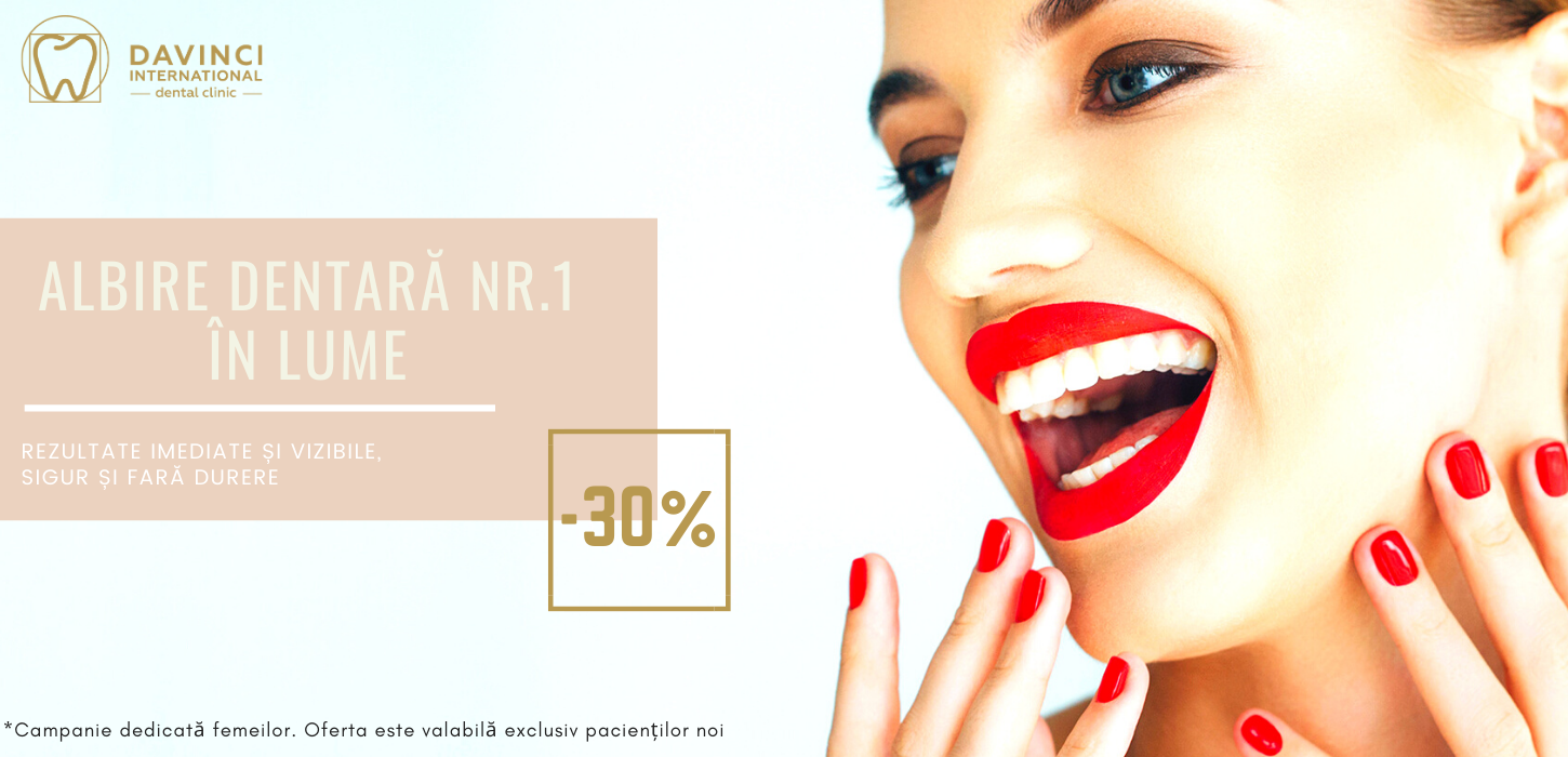 albire dentara profesionala cu lampa 100% eficient davinci dental clinic